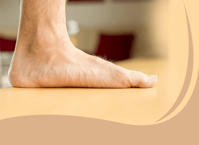 Understanding the Adult Flatfoot Deformity