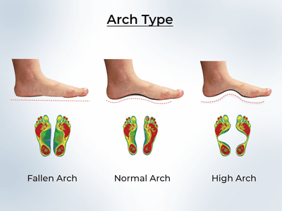 Arch Types